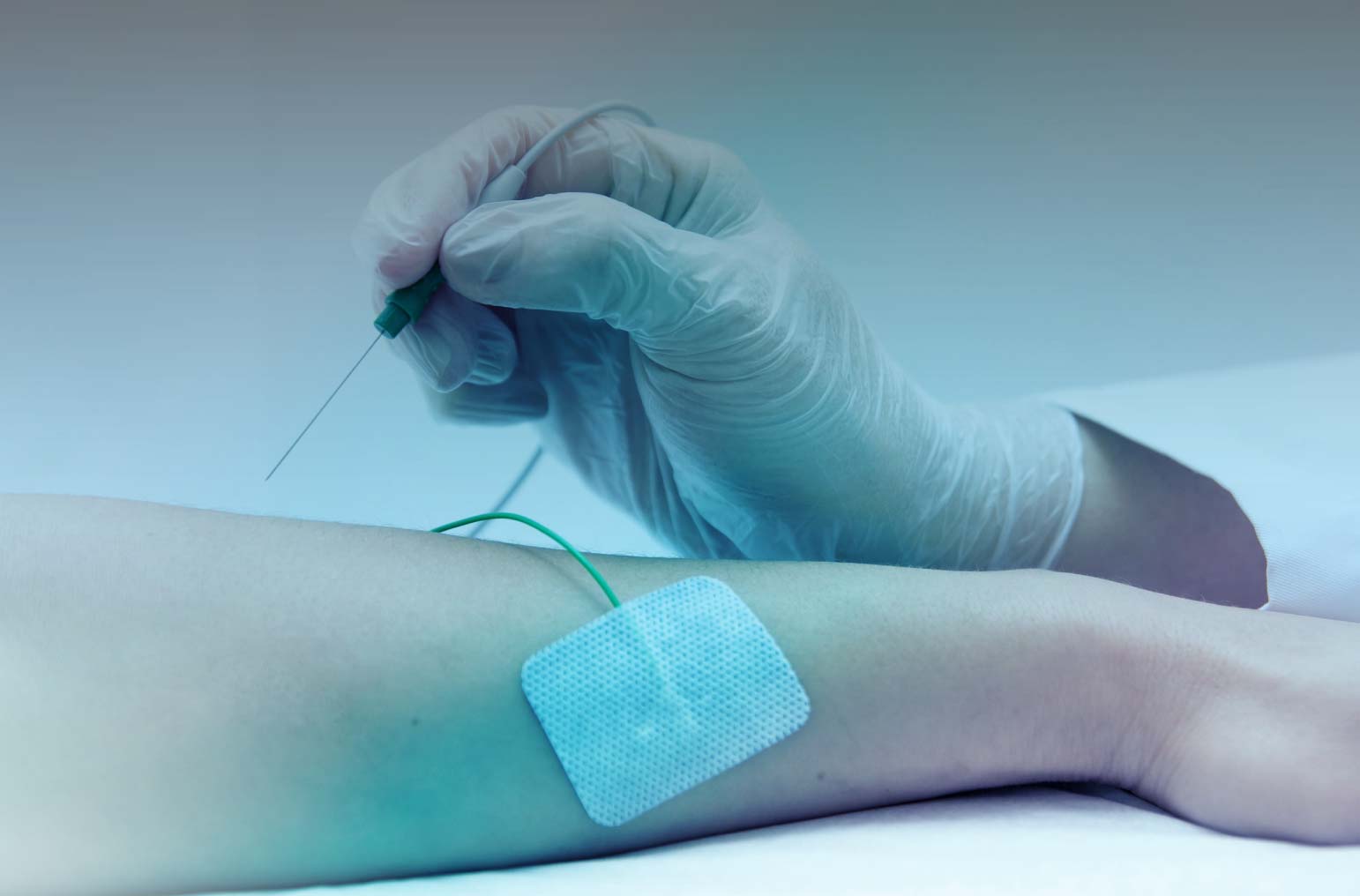 Exame de eletroneuromiografia