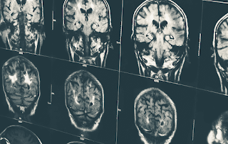 Exame de tomografia computadorizada